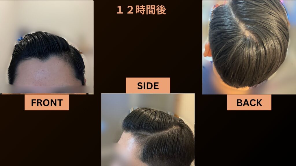 セットから12時間後もキープされているスリックバック